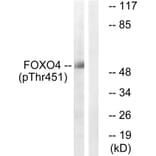 Western Blot - Anti-FOXO4 (phospho Thr451) Antibody (A1149) - Antibodies.com