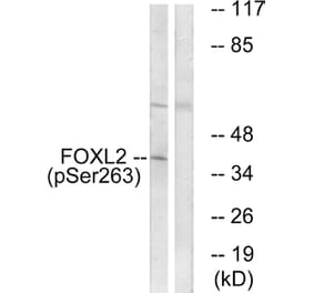 Western Blot - Anti-FOXL2 (phospho Ser263) Antibody (A1202) - Antibodies.com
