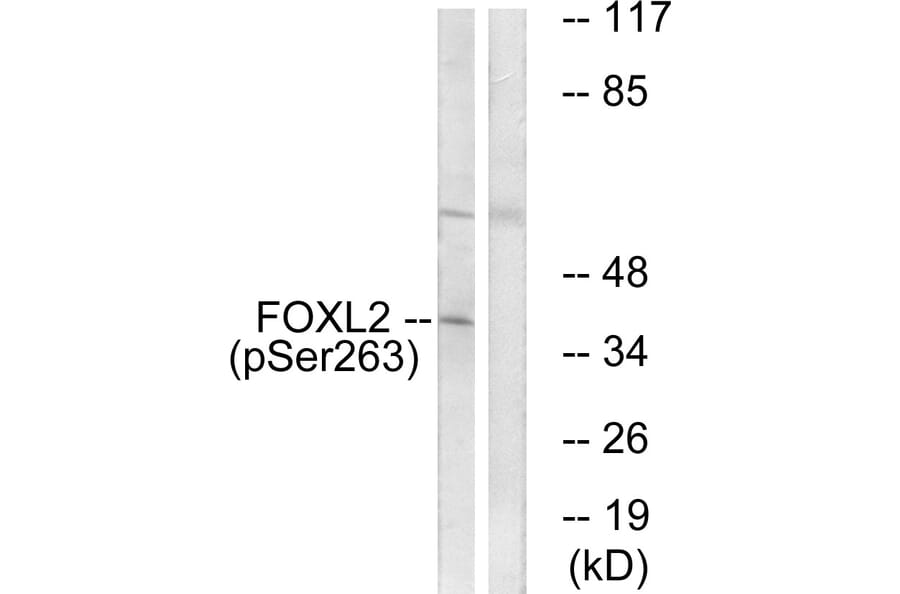 Western Blot - Anti-FOXL2 (phospho Ser263) Antibody (A1202) - Antibodies.com