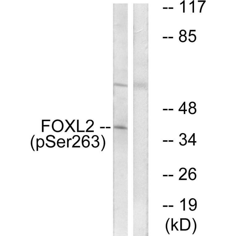 Western Blot - Anti-FOXL2 (phospho Ser263) Antibody (A1202) - Antibodies.com