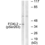 Western Blot - Anti-FOXL2 (phospho Ser263) Antibody (A1202) - Antibodies.com