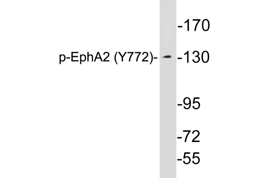 Western Blot - Anti-EphA2 (phospho Tyr772) Antibody (P12-1020) - Antibodies.com