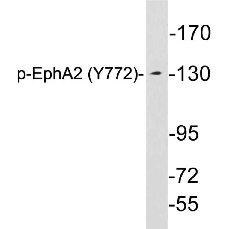 Western Blot - Anti-EphA2 (phospho Tyr772) Antibody (P12-1020) - Antibodies.com