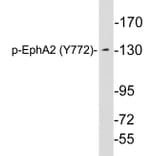 Western Blot - Anti-EphA2 (phospho Tyr772) Antibody (P12-1020) - Antibodies.com