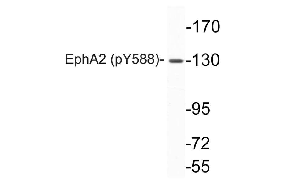 Western Blot - Anti-EphA2 (phospho Tyr588) Antibody (P12-1019) - Antibodies.com