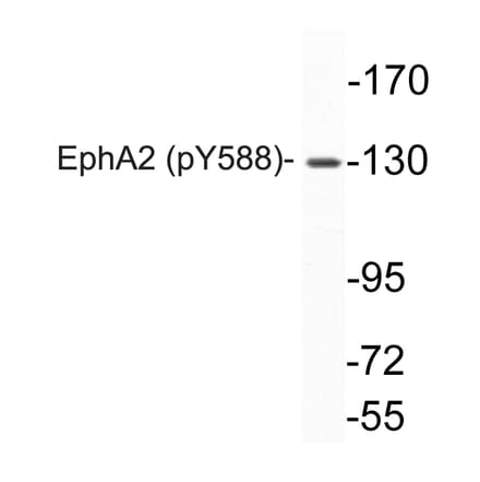 Western Blot - Anti-EphA2 (phospho Tyr588) Antibody (P12-1019) - Antibodies.com