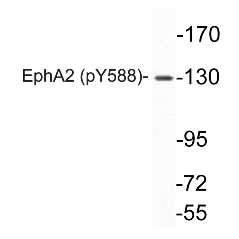 Western Blot - Anti-EphA2 (phospho Tyr588) Antibody (P12-1019) - Antibodies.com