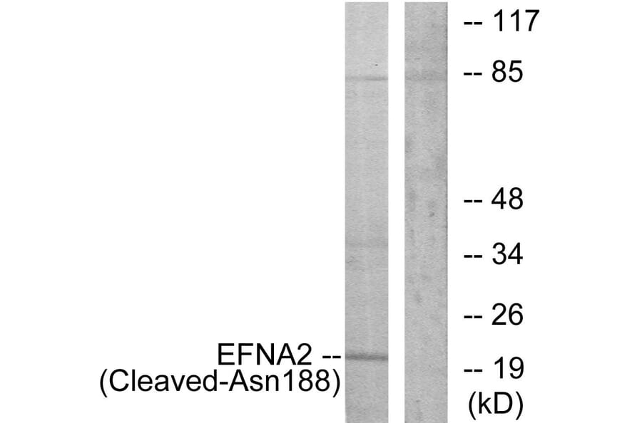 Western Blot - Anti-EFNA2 (cleaved Asn188) Antibody (L0253) - Antibodies.com