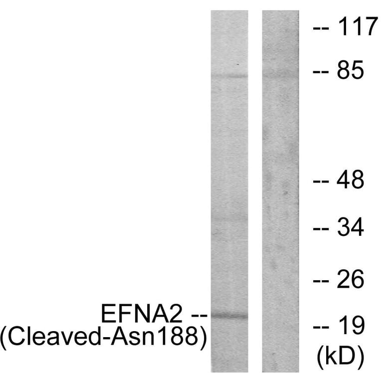 Western Blot - Anti-EFNA2 (cleaved Asn188) Antibody (L0253) - Antibodies.com