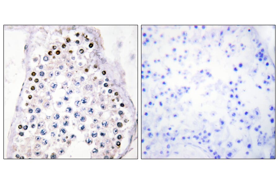 Immunohistochemistry - Anti-HOXA1 + HOXB1 + HOXD1 Antibody (C10372) - Antibodies.com
