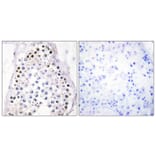 Immunohistochemistry - Anti-HOXA1 + HOXB1 + HOXD1 Antibody (C10372) - Antibodies.com