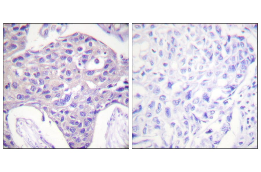 Immunohistochemistry - Anti-FOXO1 + FOXO3 + FOXO4 Antibody (B0483) - Antibodies.com