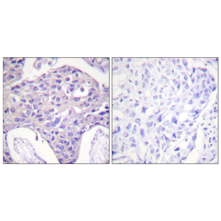 Immunohistochemistry - Anti-FOXO1 + FOXO3 + FOXO4 Antibody (B0483) - Antibodies.com