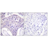 Immunohistochemistry - Anti-FOXO1 + FOXO3 + FOXO4 Antibody (B0483) - Antibodies.com
