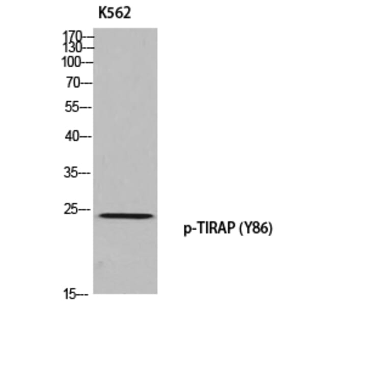 Western Blot - Anti-TIRAP (phospho Tyr86) Antibody (A8435) - Antibodies.com