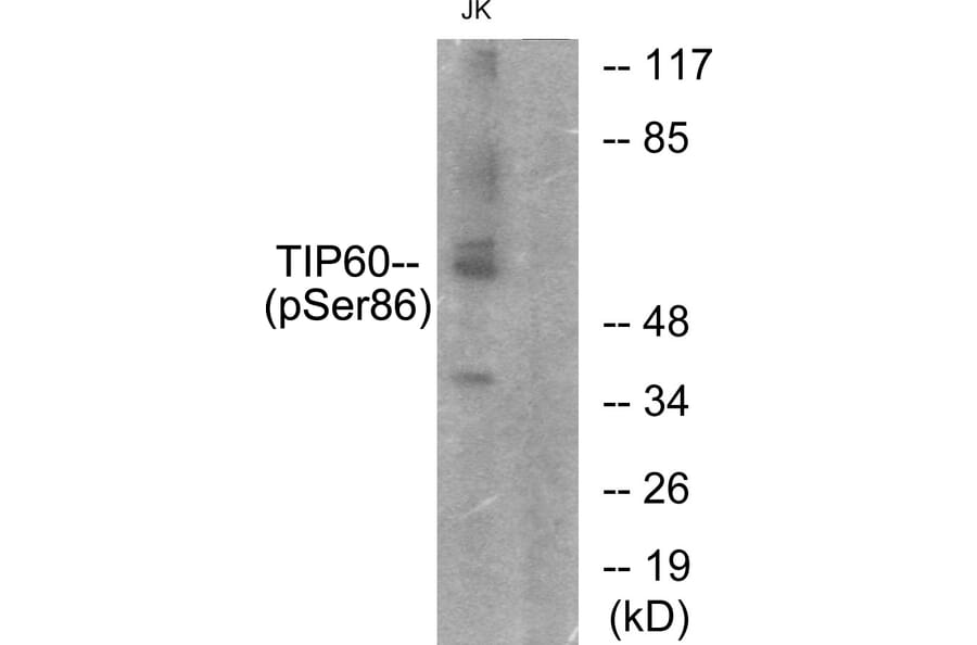 Western Blot - Anti-TIP60 (phospho Ser86) Antibody (A0814) - Antibodies.com