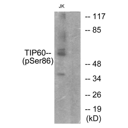 Western Blot - Anti-TIP60 (phospho Ser86) Antibody (A0814) - Antibodies.com