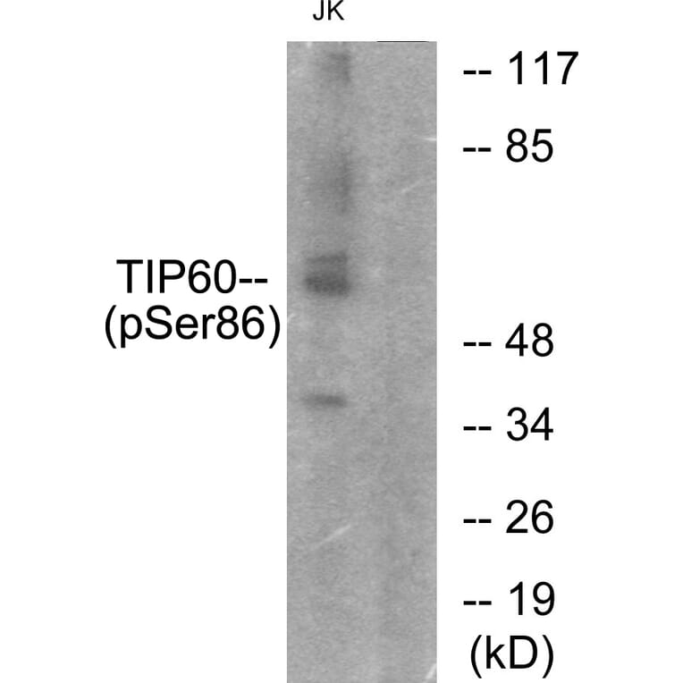 Western Blot - Anti-TIP60 (phospho Ser86) Antibody (A0814) - Antibodies.com