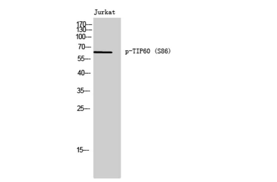 Western Blot - Anti-TIP60 (phospho Ser86) Antibody (A0814) - Antibodies.com