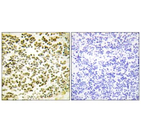Immunohistochemistry - Anti-RBL1 (phospho Thr369) Antibody (A0812) - Antibodies.com