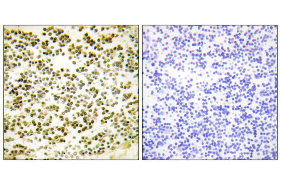 Immunohistochemistry - Anti-RBL1 (phospho Thr369) Antibody (A0812) - Antibodies.com