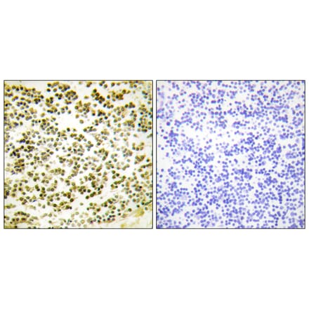 Immunohistochemistry - Anti-RBL1 (phospho Thr369) Antibody (A0812) - Antibodies.com