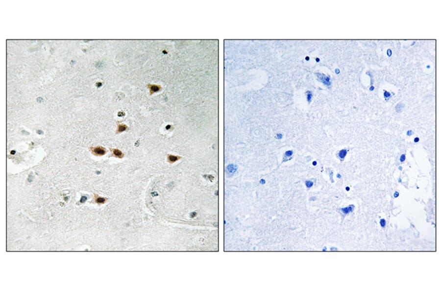 Immunohistochemistry - Anti-ITCH (phospho Tyr420) Antibody (A8254) - Antibodies.com