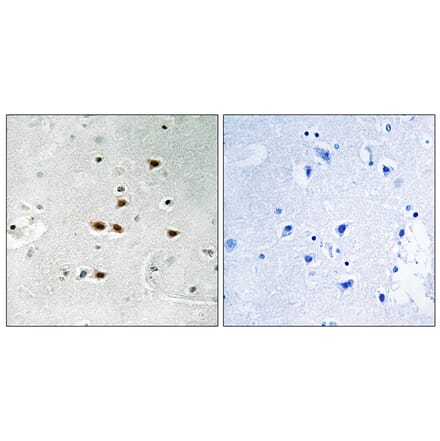 Immunohistochemistry - Anti-ITCH (phospho Tyr420) Antibody (A8254) - Antibodies.com
