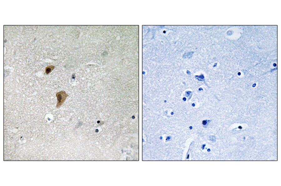 Immunohistochemistry - Anti-HSF1 (phospho Thr142) Antibody (A8040) - Antibodies.com