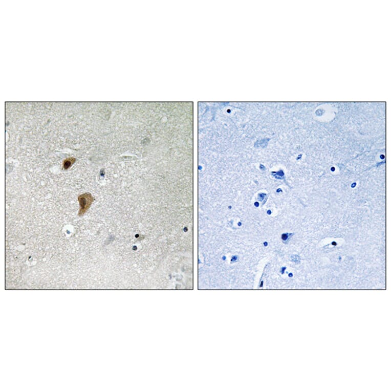 Immunohistochemistry - Anti-HSF1 (phospho Thr142) Antibody (A8040) - Antibodies.com