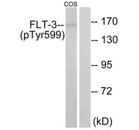 Western Blot - Anti-FLT3 (phospho Tyr599) Antibody (A0482) - Antibodies.com