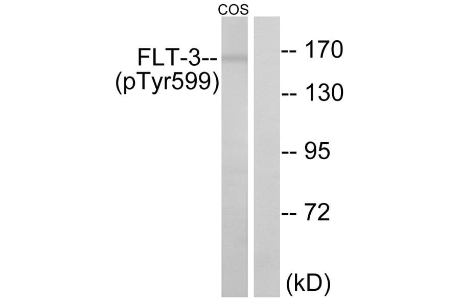 Western Blot - Anti-FLT3 (phospho Tyr599) Antibody (A0482) - Antibodies.com