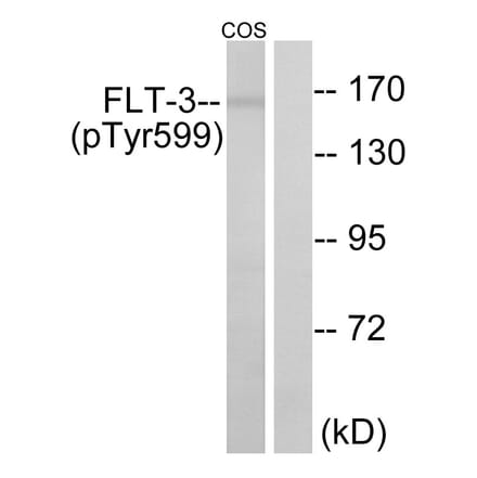 Western Blot - Anti-FLT3 (phospho Tyr599) Antibody (A0482) - Antibodies.com