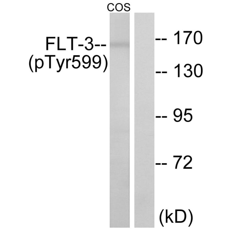 Western Blot - Anti-FLT3 (phospho Tyr599) Antibody (A0482) - Antibodies.com