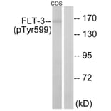 Western Blot - Anti-FLT3 (phospho Tyr599) Antibody (A0482) - Antibodies.com