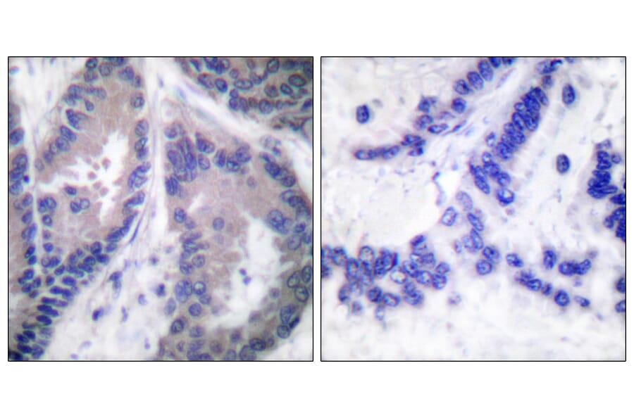 Immunohistochemistry - Anti-Collagen alpha1 XVIII Antibody (C0180) - Antibodies.com