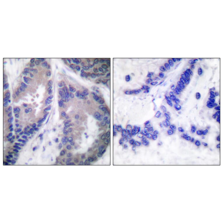 Immunohistochemistry - Anti-Collagen alpha1 XVIII Antibody (C0180) - Antibodies.com