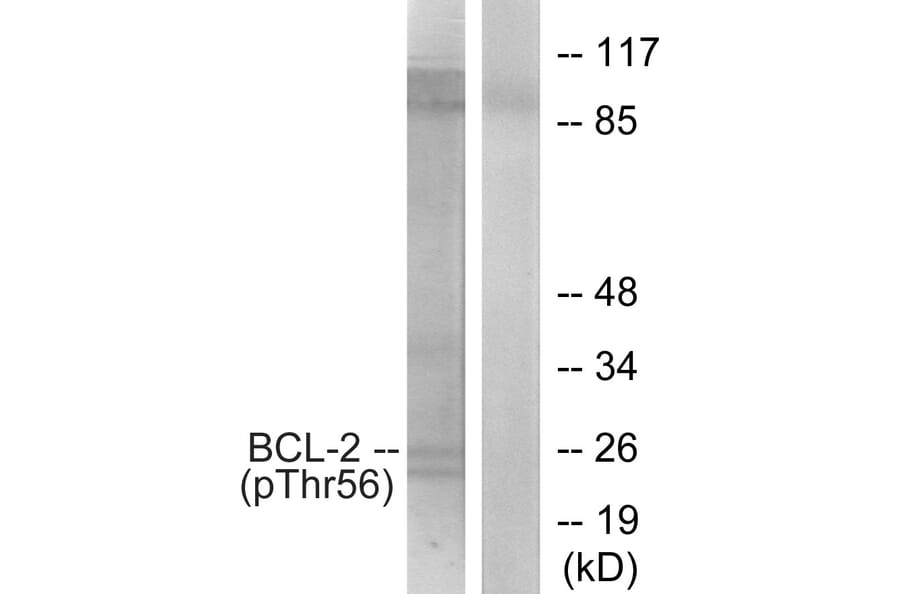Western Blot - Anti-BCL-2 (phospho Thr56) Antibody (A7026) - Antibodies.com