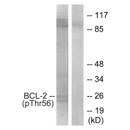 Western Blot - Anti-BCL-2 (phospho Thr56) Antibody (A7026) - Antibodies.com