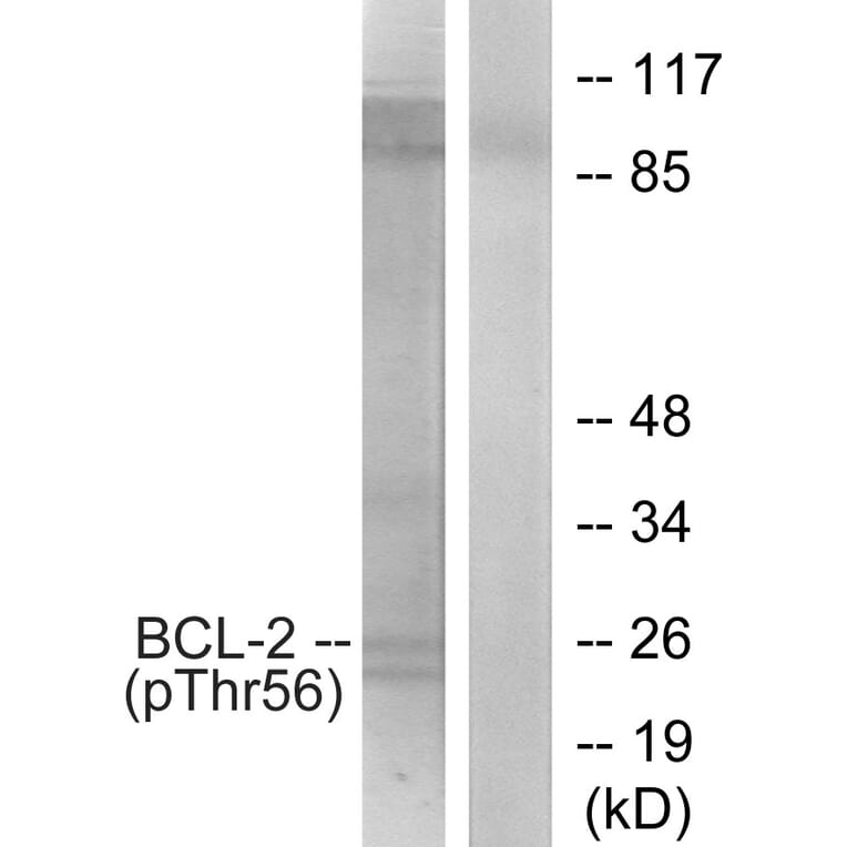 Western Blot - Anti-BCL-2 (phospho Thr56) Antibody (A7026) - Antibodies.com