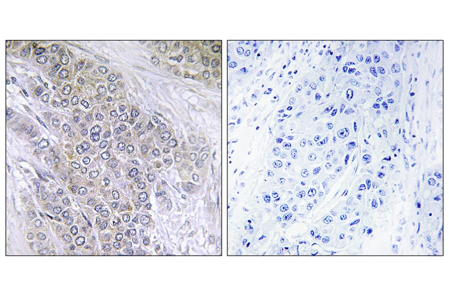 Immunohistochemistry - Anti-BCL-2 (phospho Thr56) Antibody (A7026) - Antibodies.com