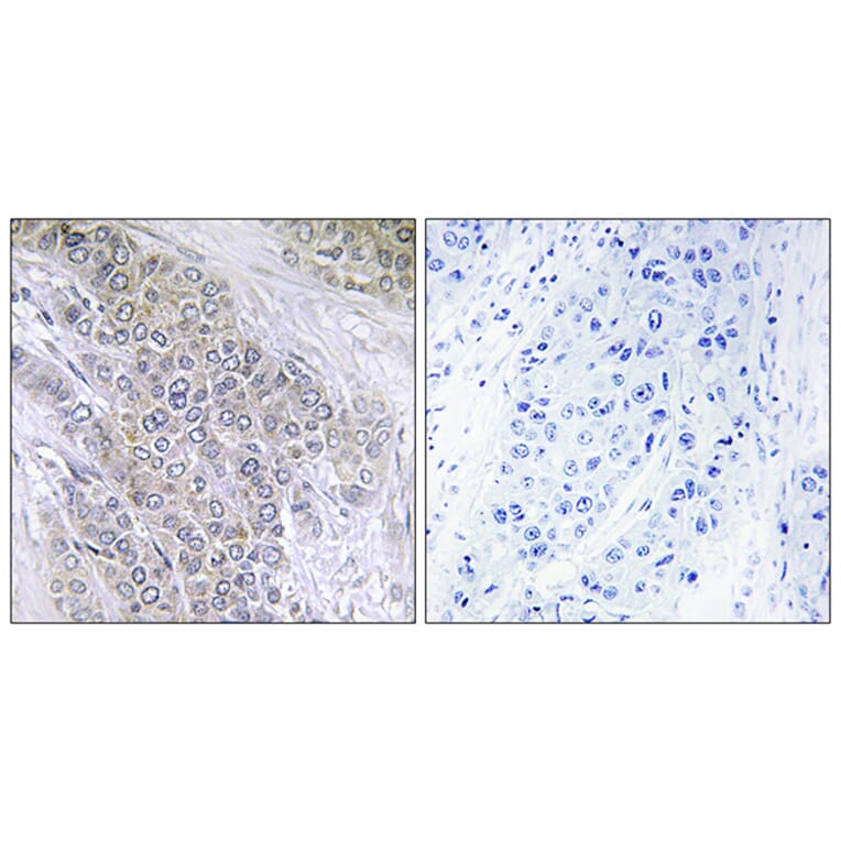 Immunohistochemistry - Anti-BCL-2 (phospho Thr56) Antibody (A7026) - Antibodies.com