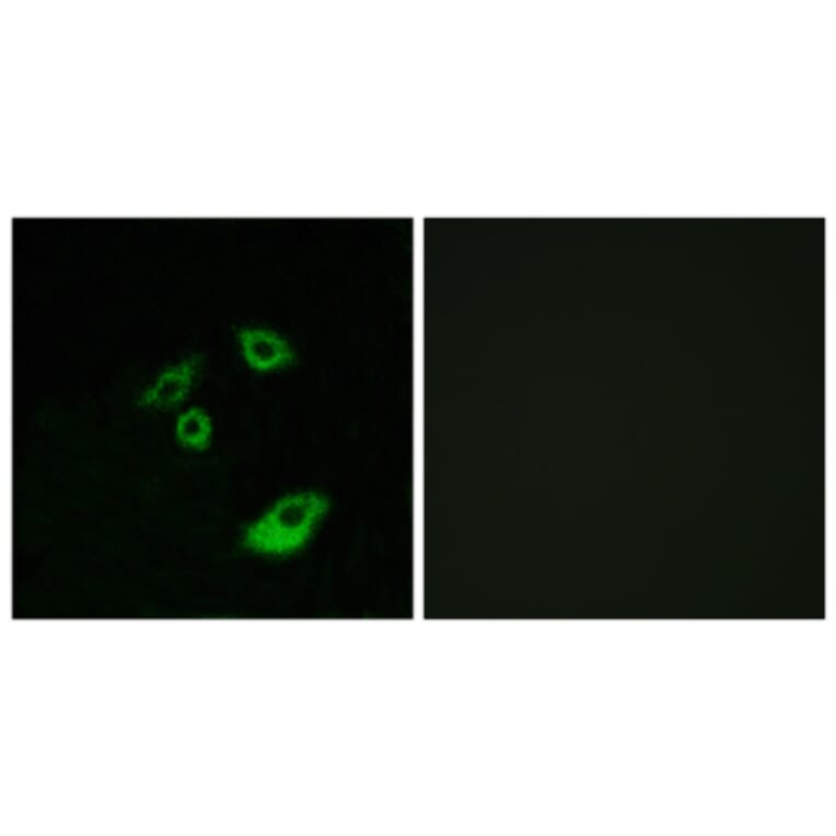 Immunofluorescence - Anti-BCL-2 (phospho Thr56) Antibody (A7026) - Antibodies.com