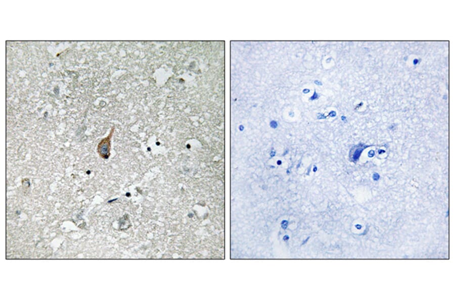 Immunohistochemistry - Anti-APC1 (phospho Ser355) Antibody (A8242) - Antibodies.com