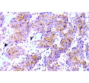 Immunohistochemistry - Anti-ALK (phospho Tyr1586) Antibody (P12-1002) - Antibodies.com