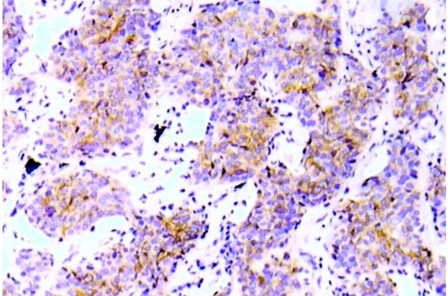 Immunohistochemistry - Anti-ALK (phospho Tyr1586) Antibody (P12-1002) - Antibodies.com