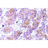 Immunohistochemistry - Anti-ALK (phospho Tyr1586) Antibody (P12-1002) - Antibodies.com