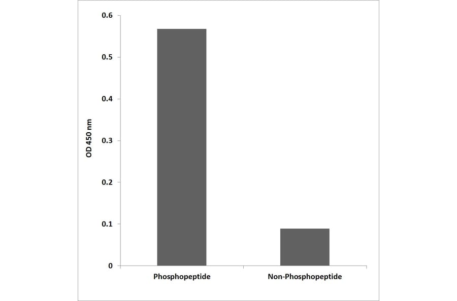 ELISA - Anti-ALK (phospho Tyr1586) Antibody (P12-1002) - Antibodies.com