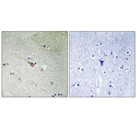 Immunohistochemistry - Anti-ALK (phospho Tyr1096) Antibody (A8077) - Antibodies.com