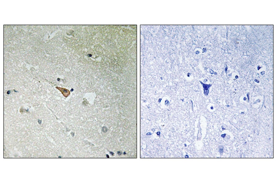 Immunohistochemistry - Anti-ALK (phospho Tyr1096) Antibody (A8077) - Antibodies.com